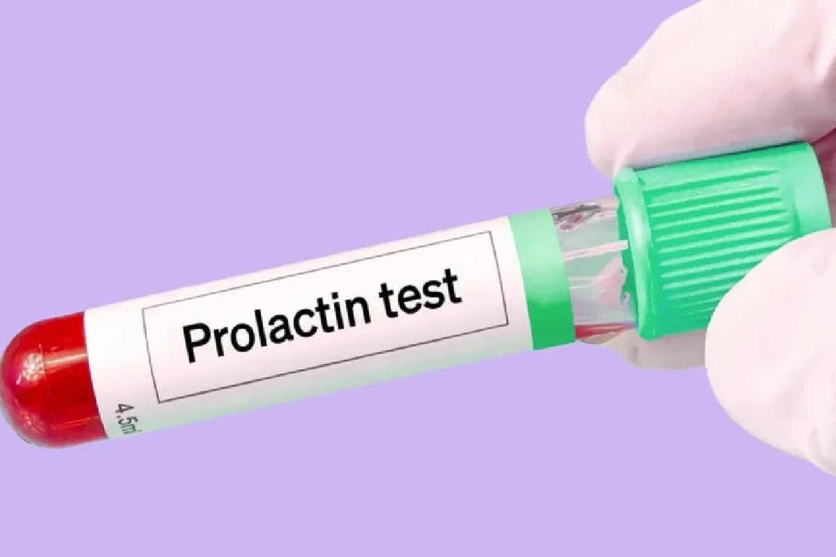 پرولاکتین (Prolactin) 