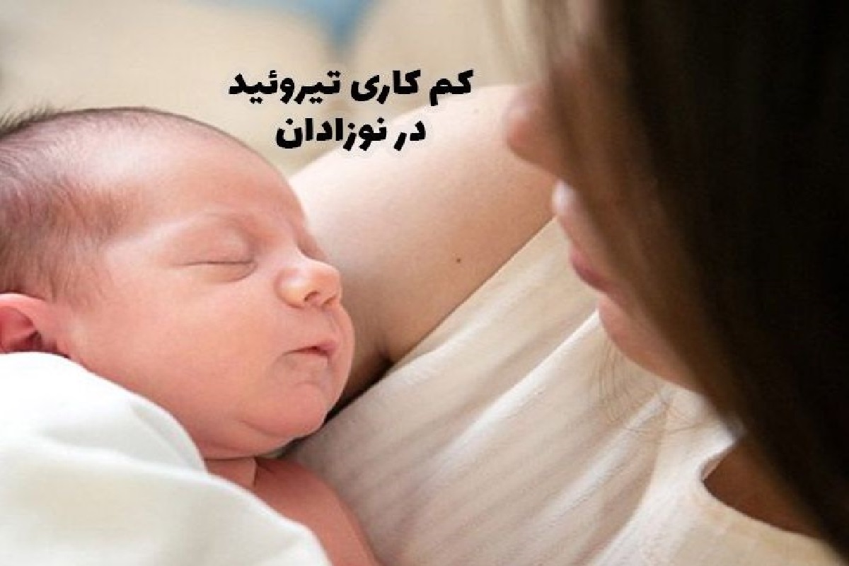 کم کاری تیروئید در نوزادان